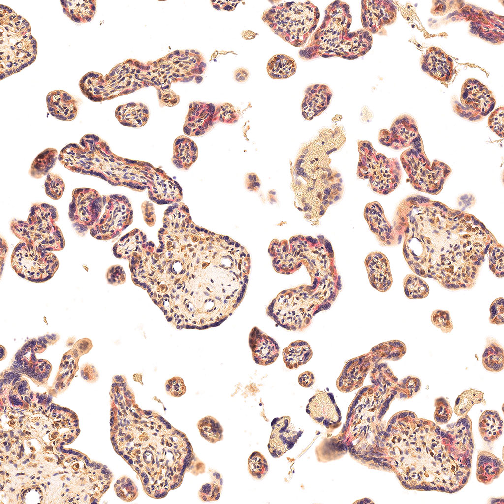 sars-cov-2 gene expression in a human fetus